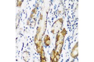 Immunohistochemistry of paraffin-embedded human gastric using NAA60 antibody (ABIN5975517) at dilution of 1/200 (40x lens). (NAT15 Antikörper)