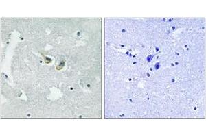 Immunohistochemistry analysis of paraffin-embedded human brain, using p47 phox (Phospho-Ser345) Antibody. (NCF1 Antikörper  (pSer345))
