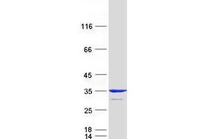 Validation with Western Blot (MITD1 Protein (Myc-DYKDDDDK Tag))