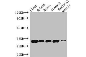 Western Blot Positive WB detected in: Mouse liver tissue, Mouse spleen tissue, Mouse brain tissue, Mouse stomach tissue, Mouse skeletal muscle tissue All lanes: GPM6A antibody at 4 μg/mL Secondary Goat polyclonal to rabbit IgG at 1/50000 dilution Predicted band size: 32, 31, 30 kDa Observed band size: 32 kDa (GPM6A Antikörper  (AA 149-213))