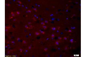 Formalin-fixed and paraffin embedded rat brain tissue labeled with Anti- phospho-PRKC Polyclonal Antibody, Unconjugated (ABIN741240) at 1:200 followed by conjugation to the secondary antibody Goat Anti-Rabbit IgG, PE conjugated used at 1:200 dilution for 40 minutes at 37°C and DAPI (PKC beta Antikörper  (pThr500))