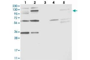 Western blot analysis of Lane 1: RT-4, Lane 2: U-251 MG, Lane 3: Human Plasma, Lane 4: Liver, Lane 5: Tonsil with OSBP2 polyclonal antibody . (OSBP2 Antikörper)