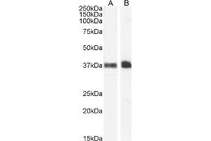 ABIN185486 (1 μg/mL) staining of Human Peripheral Blood Monocytes (A) and Kidney (B) lysate (35 μg protein in RIPA buffer). (CD235a/GYPA Antikörper  (C-Term))