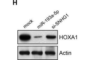 SNHG1 acts as a sponge of miR-193a-5p to activate HOXA1 expression. (HOXA1 Antikörper  (AA 75-205))