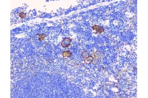 IHC analysis of CD229 using anti-CD229 antibody (ABIN6719290).