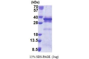 Leucine Rich Repeat Containing 59 (LRRC59) (AA 1-244) protein (His tag)