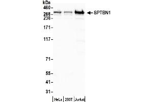 Western Blotting (WB) image for anti-Spectrin Beta, Non-Erythrocytic 1 (SPTBN1) (AA 2100-2150) antibody (ABIN7454694) (SPTBN1 Antikörper  (AA 2100-2150))