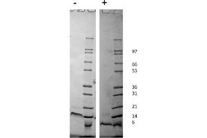 SDS-PAGE of Human Stromal Cell-Derived Factor-1 alpha (CXCL12) Recombinant Protein. (CXCL12 Protein)