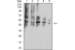 Western Blotting (WB) image for anti-Tumor Necrosis Factor Receptor Superfamily, Member 10d, Decoy with Truncated Death Domain (TNFRSF10D) (AA 56-211) antibody (ABIN5684099)