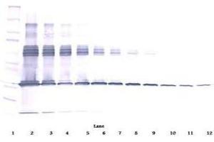 Image no. 2 for anti-Colony Stimulating Factor 1 (Macrophage) (CSF1) antibody (ABIN465551) (M-CSF/CSF1 Antikörper)