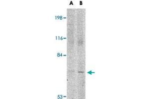 Western blot analysis of JPH1 in 293 cell lysate with JPH1 polyclonal antibody  at (A) 1 and (B) 2 ug/mL . (Junctophilin 1 Antikörper  (C-Term))