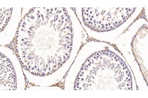 Detection of KNT1 in Rat Testis Tissue using Monoclonal Antibody to T-Kininogen 1 (KNT1) (KNG1 Antikörper  (AA 378-430))