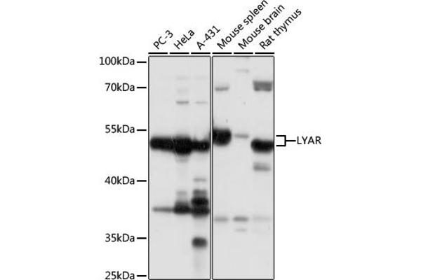 LYAR Antikörper  (AA 10-160)