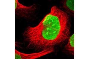 Immunofluorescence of U-2 OS cell line with SUB1 polyclonal antibody  shows positivity in nucleus and nucleoli.