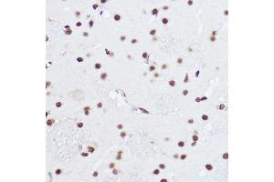 Immunohistochemistry (IHC) image for anti-Squamous Cell Carcinoma Antigen Recognized By T Cells (SART1) (AA 1-255) antibody (ABIN6147390)