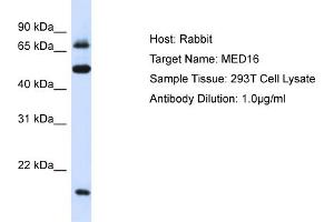 Host: Rabbit Target Name: MED16 Sample Type: 293T Whole Cell lysates Antibody Dilution: 1. (MED16 Antikörper  (Middle Region))