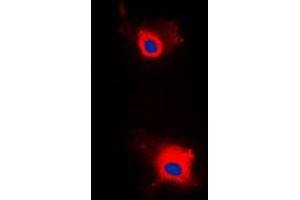 Immunofluorescent analysis of IRS1 (pS636) staining in MCF7 cells. (IRS1 Antikörper  (pSer636))