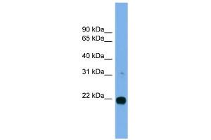 Western Blotting (WB) image for anti-MIT, Microtubule Interacting and Transport, Domain Containing 1 (MITD1) (Middle Region) antibody (ABIN2785027)