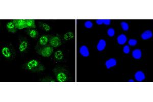 Immunofluorescence analysis of HUVEC cells using Phospho-JNK1/2/3-T183/T183/T221 antibody (abx125450).