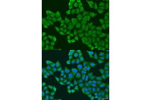 Immunofluorescence analysis of U2OS cells using ULBP2 antibody (ABIN6293785) at dilution of 1:100.