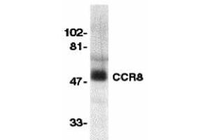 Western Blotting (WB) image for anti-Chemokine (C-C Motif) Receptor 8 (CCR8) (Extracellular Loop) antibody (ABIN1030839)