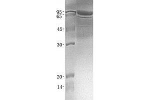 Validation with Western Blot (PDILT Protein)