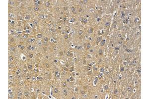 ABIN6258288 and ABIN6275675 at 1/100 staining rat brain tissue by IHC-P.