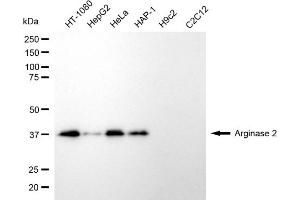 Western blotting analysis using arginase 2 antibody (ABIN7797645). (ARG2 Antikörper)
