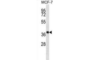 Western Blotting (WB) image for anti-Dehydrogenase/reductase (SDR Family) Member 7B (DHRS7B) antibody (ABIN2997289) (DHRS7B Antikörper)