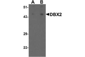Western blot analysis of DBX2 in human kidney tissue lysate with DBX2 antibody at (A) 1 and (B) 2 ug/mL. (DBX2 Antikörper  (N-Term))