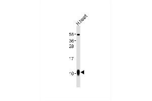 Anti--A1 Antibody at 1:1000 dilution + human heart lysates Lysates/proteins at 20 μg per lane. (S100A1 Antikörper)