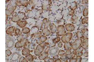 Image no. 1 for anti-F-Box and Leucine-Rich Repeat Protein 18 (FBXL18) (AA 1-111) antibody (ABIN466244) (FBXL18 Antikörper  (AA 1-111))