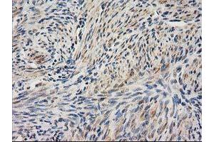 Immunohistochemical staining of paraffin-embedded Human endometrium tissue using anti-UBA2 mouse monoclonal antibody.