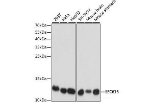 Western blot analysis of extracts of various cell lines using SEC61B Polyclonal Antibody at dilution of 1:1000. (SEC61B Antikörper)