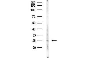 anti-Lin-7 Homolog C (LIN7C) (Internal Region) antibody