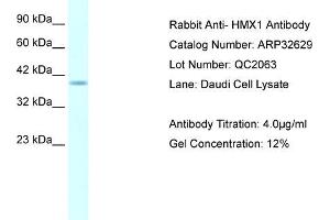Human Daudi; WB Suggested Anti-HMX1 AntibodyTitration: 4. (HMX1 Antikörper  (Middle Region))