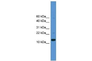 WB Suggested Anti-CASP1  Antibody Titration: 0. (Caspase 1 Antikörper  (Middle Region))