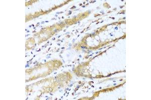 Immunohistochemistry (Paraffin-embedded Sections) (IHC (p)) image for anti-Ubiquitin-Conjugating Enzyme E2L 3 (UBE2L3) (AA 73-212) antibody (ABIN1683196)