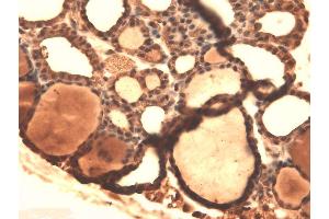 Immunohistochemistry analysis using Mouse Anti-Sodium Iodide Symporter Monoclonal Antibody, Clone 14F .