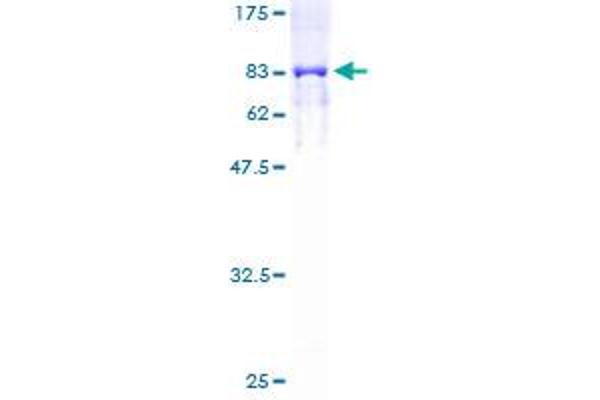 Keratin 6B Protein (KRT6B) (AA 1-564) (GST tag)