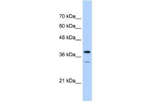 PGAM2 antibody used at 1 ug/ml to detect target protein. (PGAM2 Antikörper)