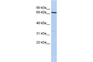 WB Suggested Anti-PRDM1 Antibody Titration:  0. (PRDM1 Antikörper  (Middle Region))
