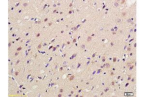 Formalin-fixed and paraffin embedded rat brain labeled with Anti-mGluR4 Polyclonal Antibody, Unconjugated (ABIN735998) at 1:200 followed by conjugation to the secondary antibody