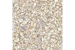 IHC analysis of TXNDC5 using anti-TXNDC5 antibody (ABIN7599699).