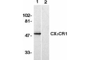 Image no. 1 for anti-Chemokine (C-X3-C Motif) Receptor 1 (CX3CR1) (AA 2-21) antibody (ABIN201961) (CX3CR1 Antikörper  (AA 2-21))