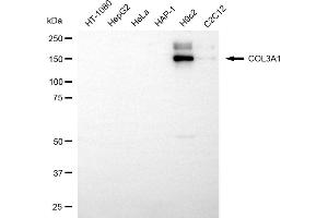 Western blotting analysis using COL3A1 antibody (ABIN7798124).