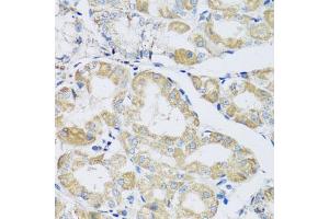 Immunohistochemistry of paraffin-embedded human stomach using ATPIF1 antibody (ABIN5972942) at dilution of 1/100 (40x lens).