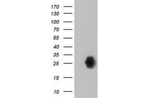 Western Blotting (WB) image for anti-Zinc Finger, AN1-Type Domain 2B (ZFAND2B) antibody (ABIN1501801) (ZFAND2B Antikörper)