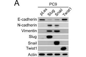 Snail- and Slug-induced EMT promoted drug resistance of parental PC9 and HCC827 cells. (TWIST1 Antikörper  (Center))