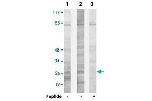 Western blot analysis of extracts from HepG2 cells (Lane 1) and HeLa cells (Lane 2 and lane 3), using SPIC polyclonal antibody . (SPIC Antikörper)